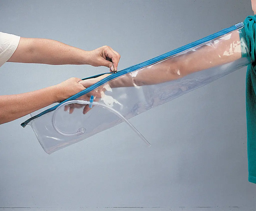 Attelle Urias®-Johnstone pour le bras (chambre simple)